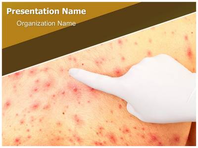 Dermatologist Editable PowerPoint Template