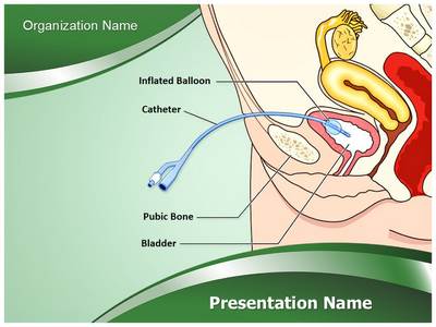 Catheter Female Editable PowerPoint Template