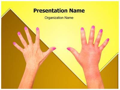 Sepsis Swelling Editable PowerPoint Template