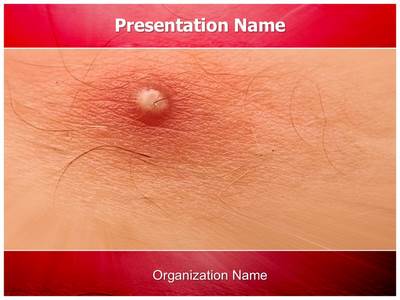 Skin Boils Editable PowerPoint Template