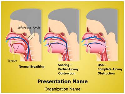 Snoring and Sleep Apnea Editable PowerPoint Template