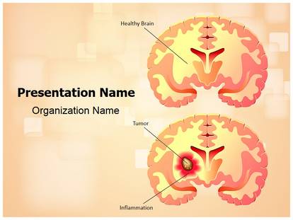 Free Brain Tumor Medical PowerPoint Template for Medical PowerPoint ...