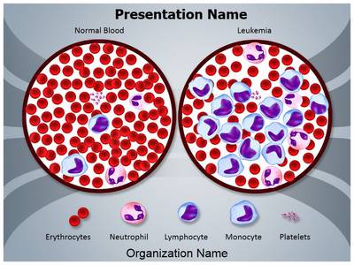 Leukemia Diagnosis Editable PowerPoint Template