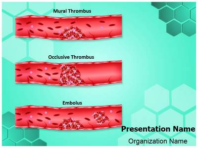 Thrombosis Types Editable PowerPoint Template