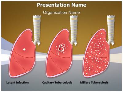 Tuberculosis Types Editable PowerPoint Template