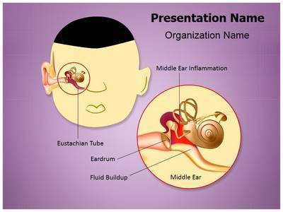 Otitis Media Eustachian Editable PowerPoint Template