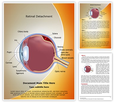 Retinal detachment Editable Word Template