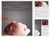 Burned Hand Editable PowerPoint Template