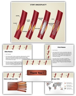 Coronary Stent