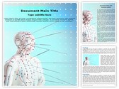 Alternative medicine Acupuncture