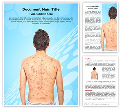 Chickenpox rash Editable Word Template