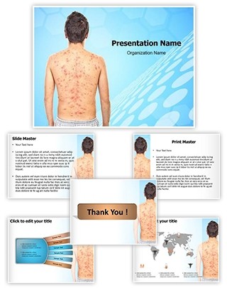 Chickenpox Rash Editable PowerPoint Template