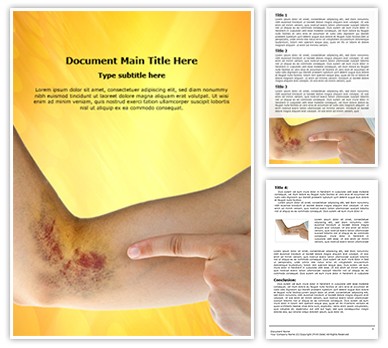 Hematoma Editable Word Template