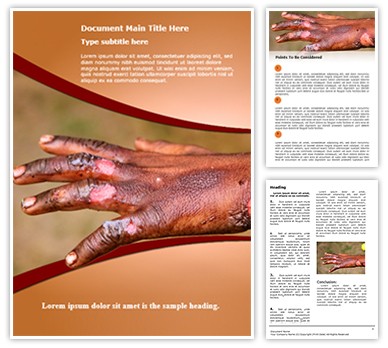 Burn Injuries Editable Word Template