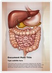 Abdominal compartment syndrome Editable Template