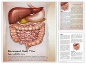 Abdominal compartment syndrome Editable PowerPoint Template