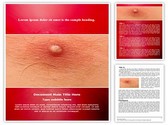 Skin Boils Editable PowerPoint Template