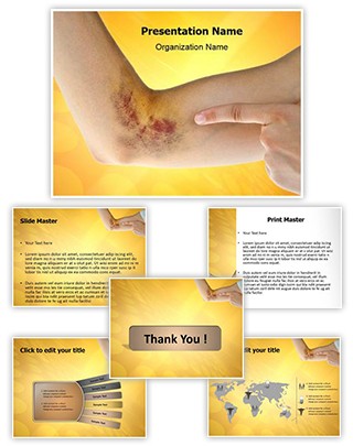 Hematoma Editable PowerPoint Template