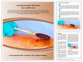 Iodine Swab Template