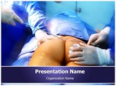 Coccygectomy Template