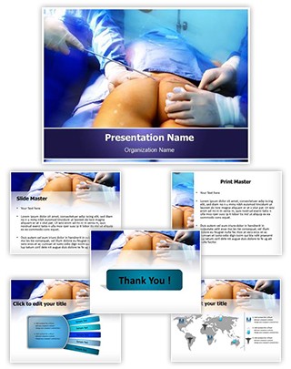 Coccygectomy Editable PowerPoint Template