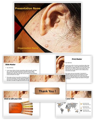 Chicken Pox Behind Ears Editable PowerPoint Template