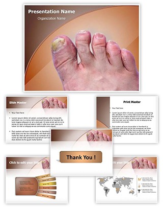 Toenail Mycosis Editable PowerPoint Template