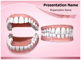 Dental Openbite Editable Template