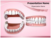 Dental Openbite Editable PowerPoint Template