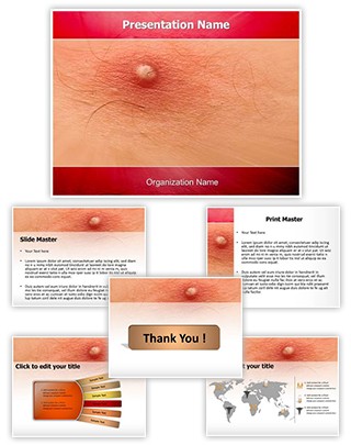 Skin Boils Editable PowerPoint Template