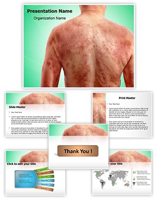 Yeast Infection Editable PowerPoint Template