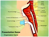 Tracheostomy Template