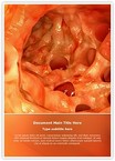 Diverticulosis Editable Template