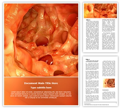 Diverticulosis Editable Word Template