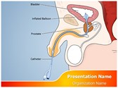 Catheter Male