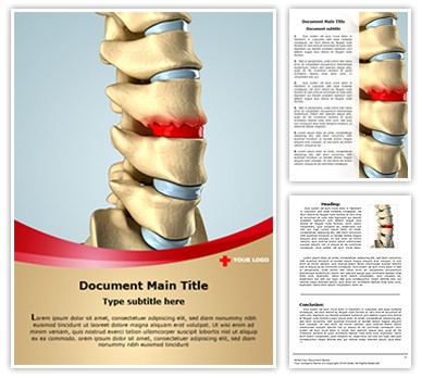 Disc Osteophyte Formation Editable Word Template