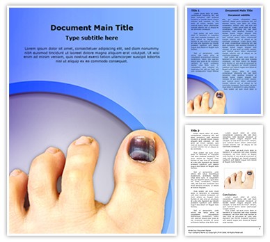 Nail Hematoma Editable Word Template