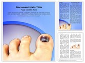 Nail Hematoma Template