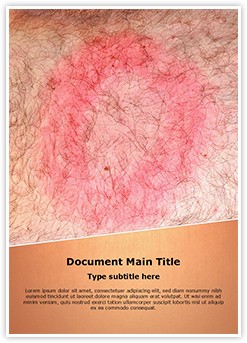 Lyme Disease Editable Word Template