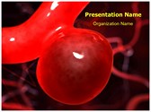 Aneurysm Anatomy Editable PowerPoint Template