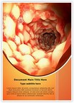 Inflammatory Bowel