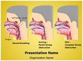 Snoring and Sleep Apnea Editable PowerPoint Template