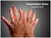 Arthritis Editable PowerPoint Template