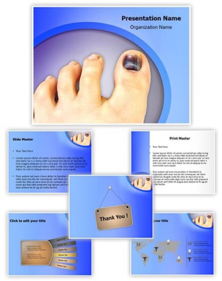 Nail Hematoma Editable PowerPoint Template