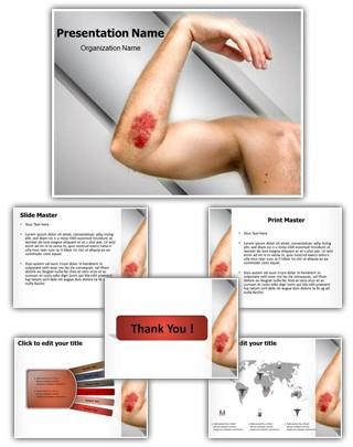 Abrasion Editable PowerPoint Template