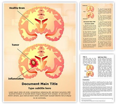 Brain Tumor Editable Word Template