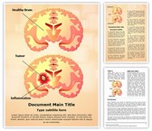 Brain Tumor