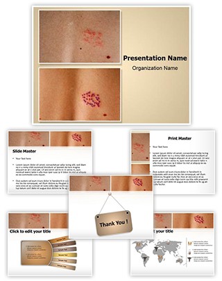 Herpes Zoster Editable PowerPoint Template