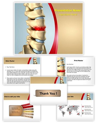 Disc Osteophyte Formation