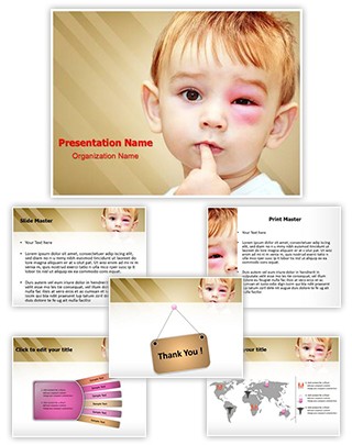 Wasps Stings Infection Editable PowerPoint Template